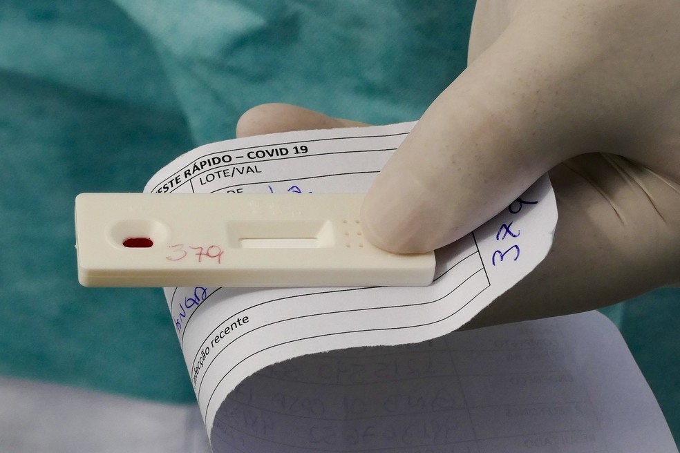 Confirmado primeiro caso da variante ômicron no Rio de Janeiro