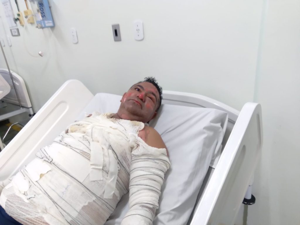 Mulher tenta matar vizinho com óleo quente no litoral do RN