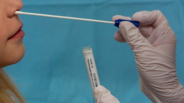 Laboratório em Natal registra aumento de 400% na busca por testes de Covid-19