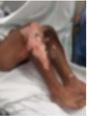 Criminosos ateiam fogo em turista