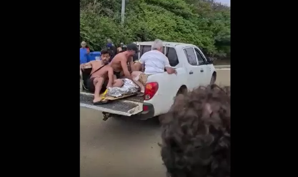 Menina mordida por tubarão em praia de Noronha teve perna amputada, diz boletim médico