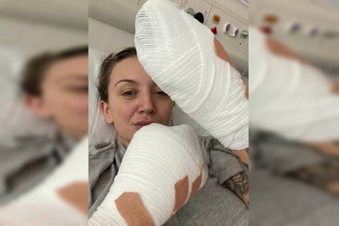 Mulher desmaia com dor nas costas e acorda sem os dedos