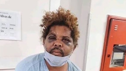 Sem-teto agredido por personal diz que mulher o convidou para 'brincar'