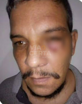 Motorista por aplicativo é agredido após pedir que passageiro use cinto de segurança na Grande Natal
