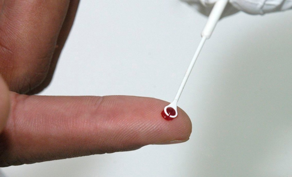 RN aumenta em 36,8% o número de casos de AIDS em 10 anos