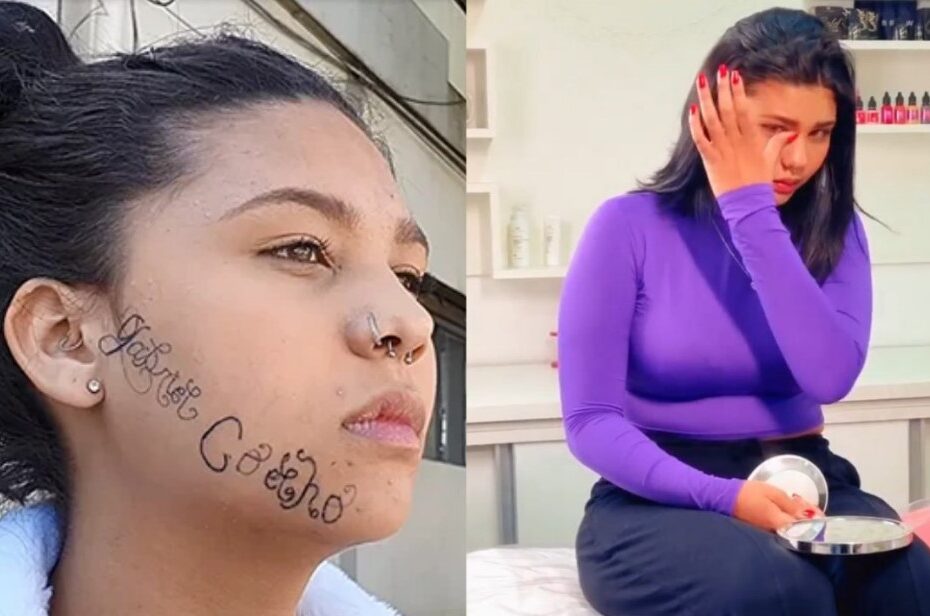 VÍDEO: ‘Me sinto livre’, diz jovem ao iniciar remoção de tatuagem feita no rosto pelo ex-namorado