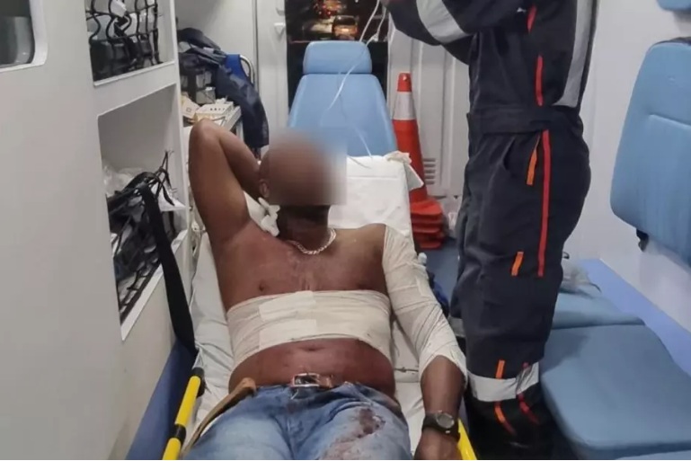 Homem leva 7 facadas e diz à polícia que motivação do crime foi ele ser muito bonito