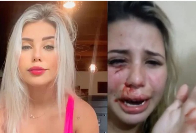 “Me ajuda, por favor!”: influencer é espancada e pede socorro nas redes