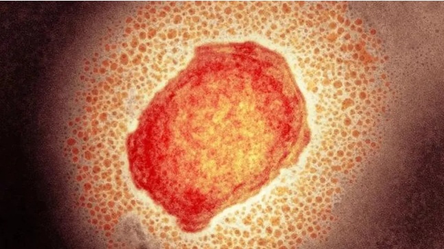 RN tem 60 casos confirmados de varíola dos macacos em 11 municípios