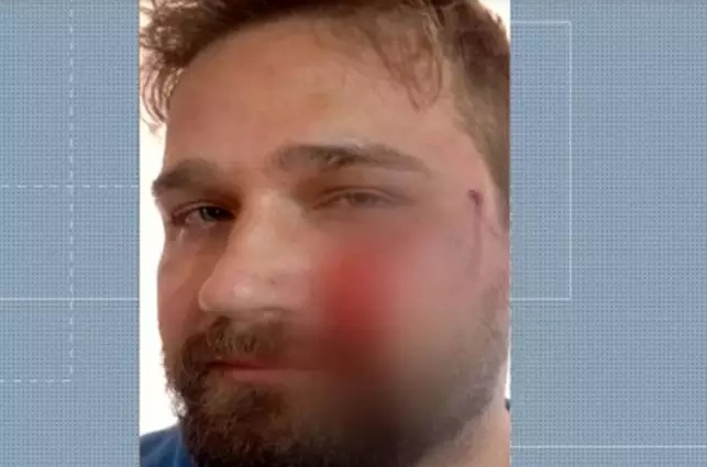 Médico é agredido com capacete após negar atestado para adolescente
