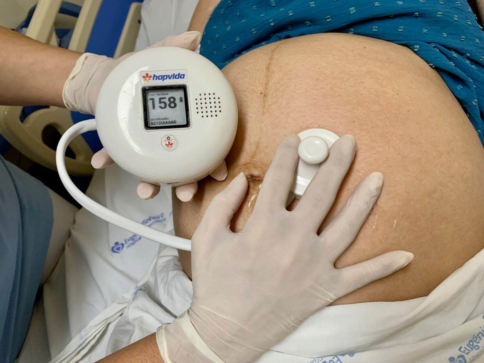 Detector de frequência cardíaca fetal com Inteligência Artificial já é realidade no Brasil