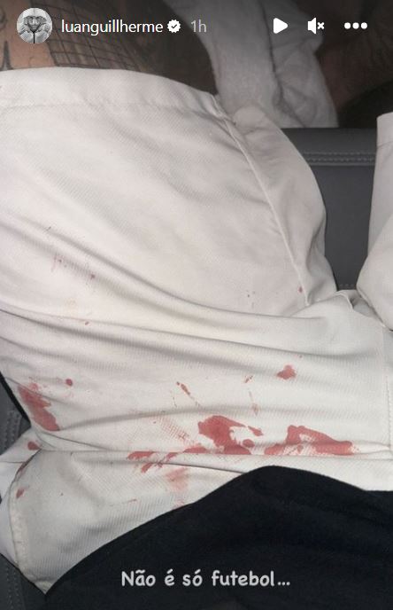 Jogador do Corinthians publica foto com roupa ensanguentada após agressão de torcedores