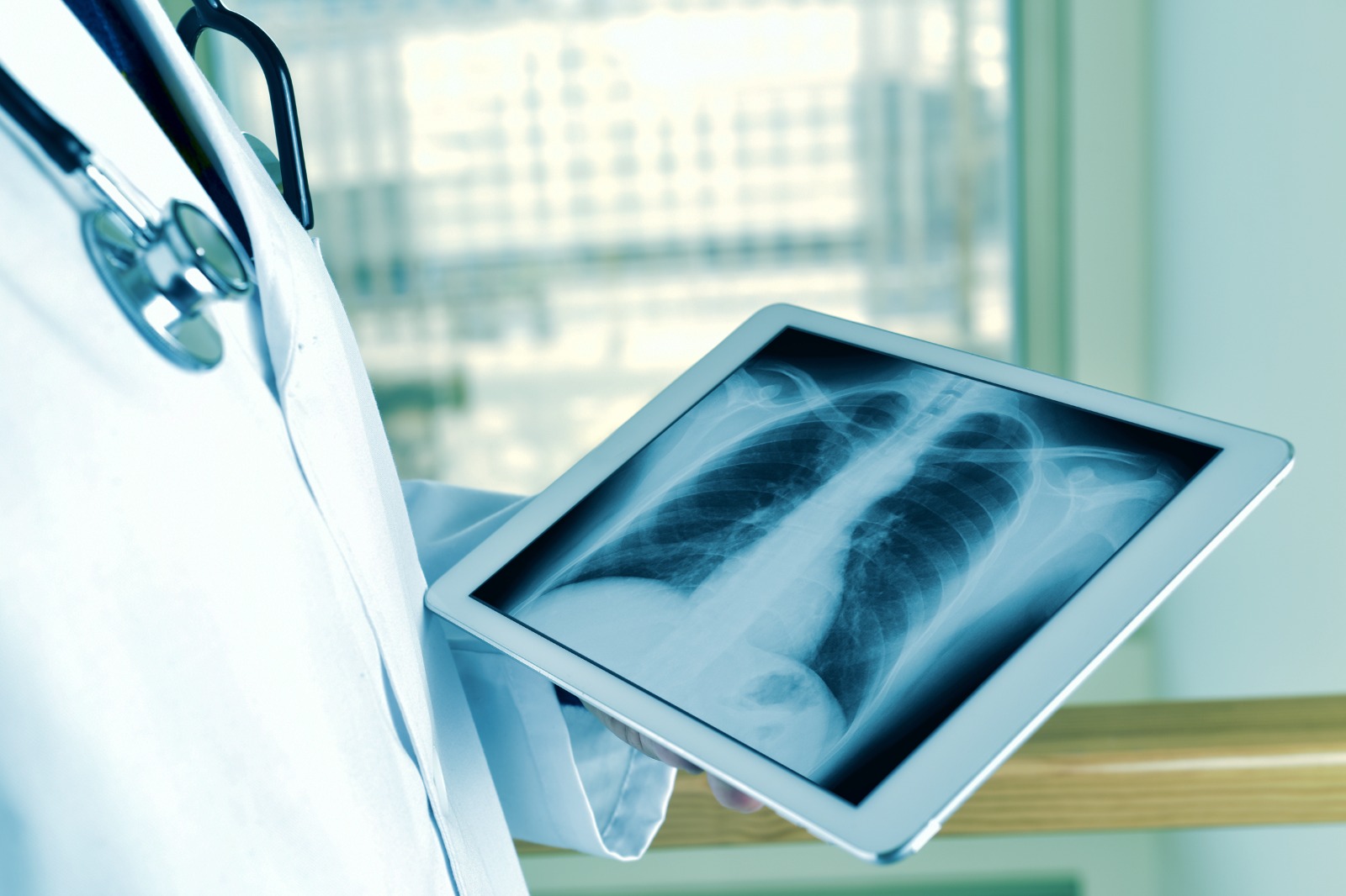 Telerradiologia: tecnologia garante diagnóstico de qualidade para todo Brasil