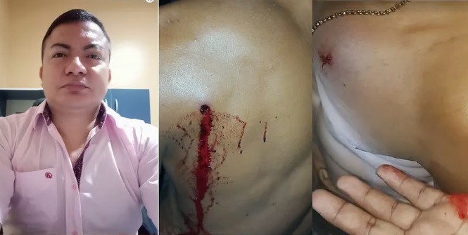 Vereador é preso por atirar contra morador de assentamento