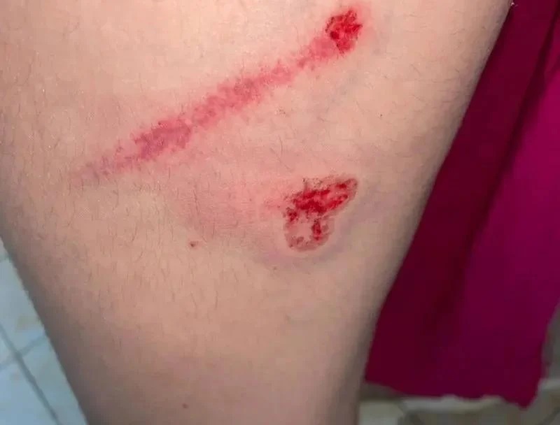 Mulher pula de carro em movimento para escapar de estupro