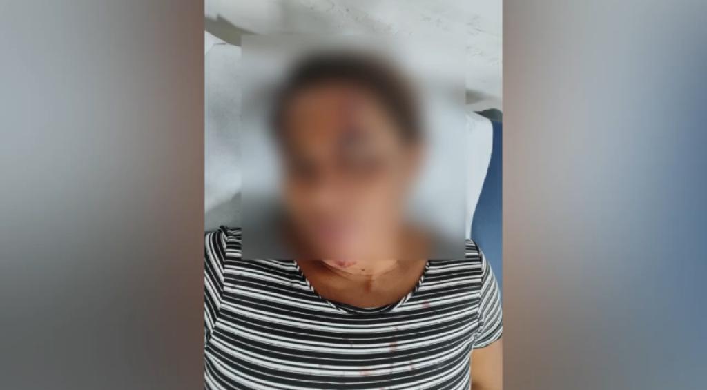Mulher é agredida devido a suposta dívida de drogas do filho em Assú