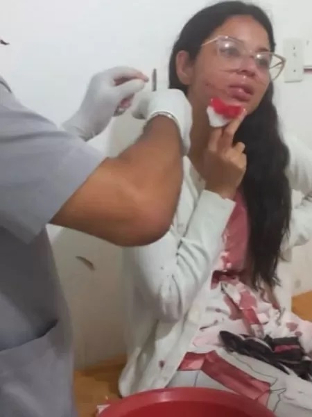 Suspeita de cortar rosto de jovem em viagem de ônibus na BA é presa em SP