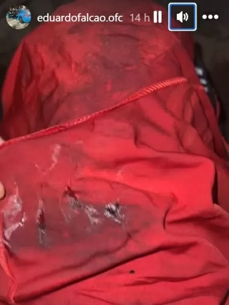 Cantor é baleado após briga de trânsito no Piauí: 'Tiro atravessou a perna'