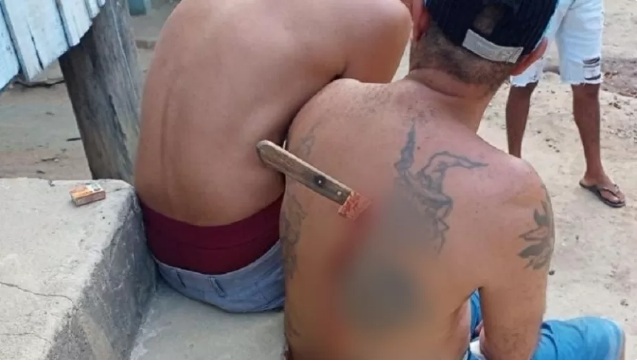 Homem esfaqueado após discussão fica com faca cravada nas costas
