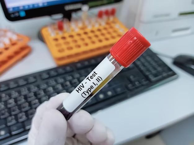 Casos de HIV/aids notificados no RN registram queda de mais de 40%