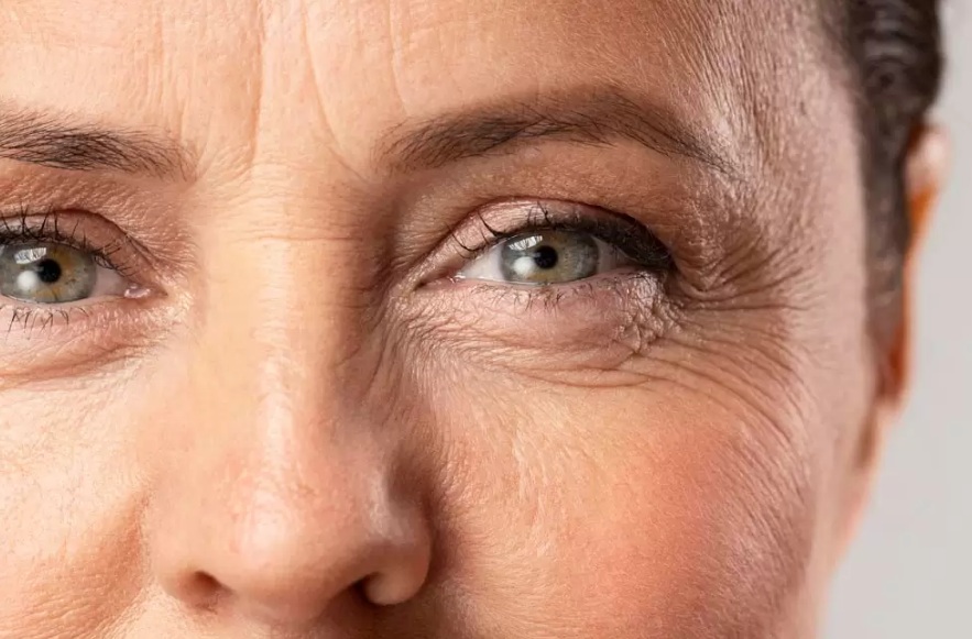 Conheça a blefaroplastia, cirurgia plástica que melhora a visão e rejuvenesce