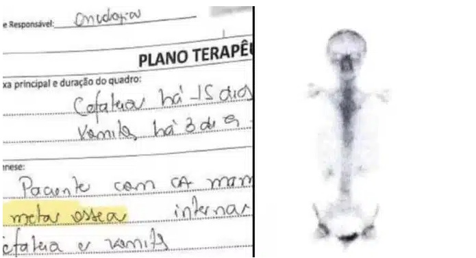 Mulher enfrenta tratamento de câncer por engano durante 6 anos devido a erro médico