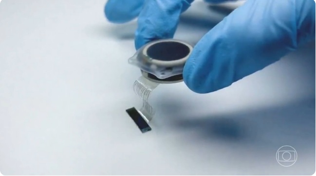Empresa de Elon Musk faz 1º implante de chip cerebral em humano